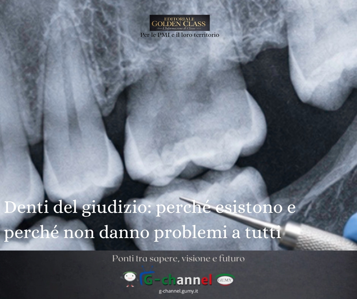 Denti del giudizio: perché esistono e perché non danno problemi a tutti
